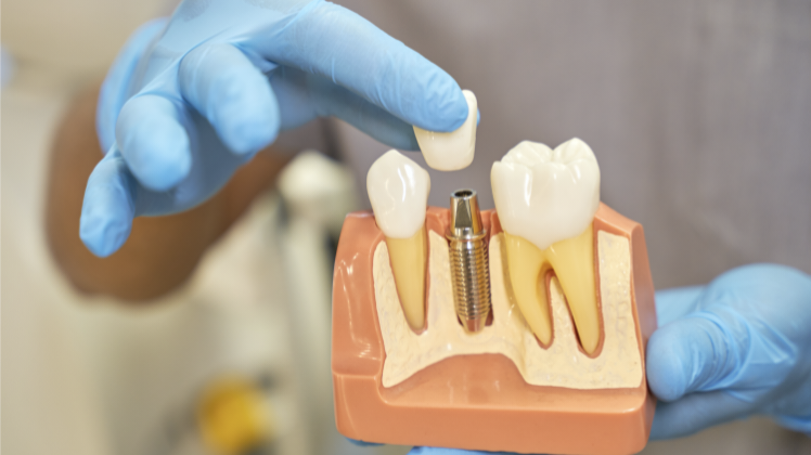 Dental Implant discomfort