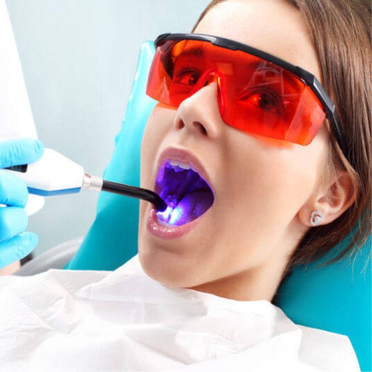 Teeth Filling at the Dental Office