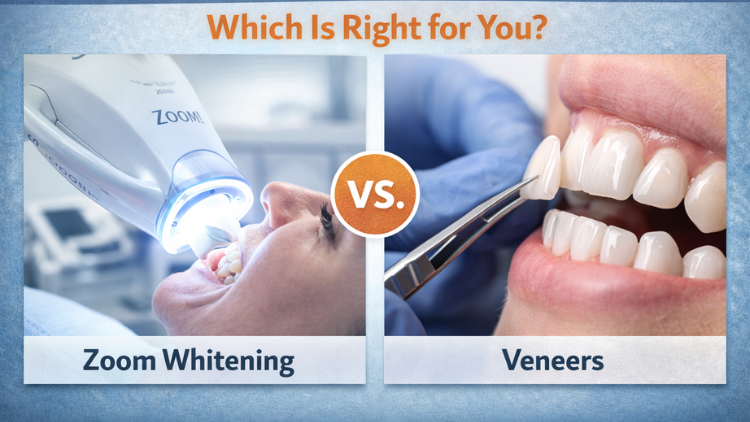 Zoom Whitening vs. Veneers Which Is Right for You