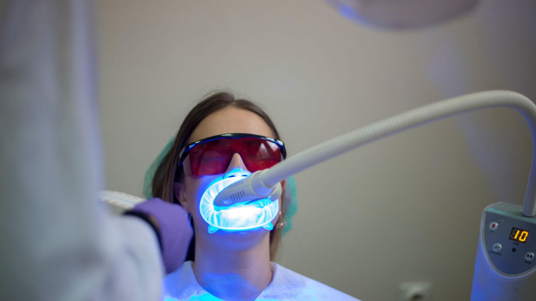 Zoom Whitening Before and After really expect